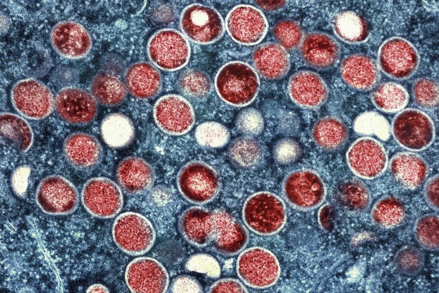A colorized electron microscope image provided by the National Institute of Allergy and Infectious Diseases shows mpox particles, red, found within an infected cell, blue, cultured in a laboratory in Fort Detrick, Maryland.